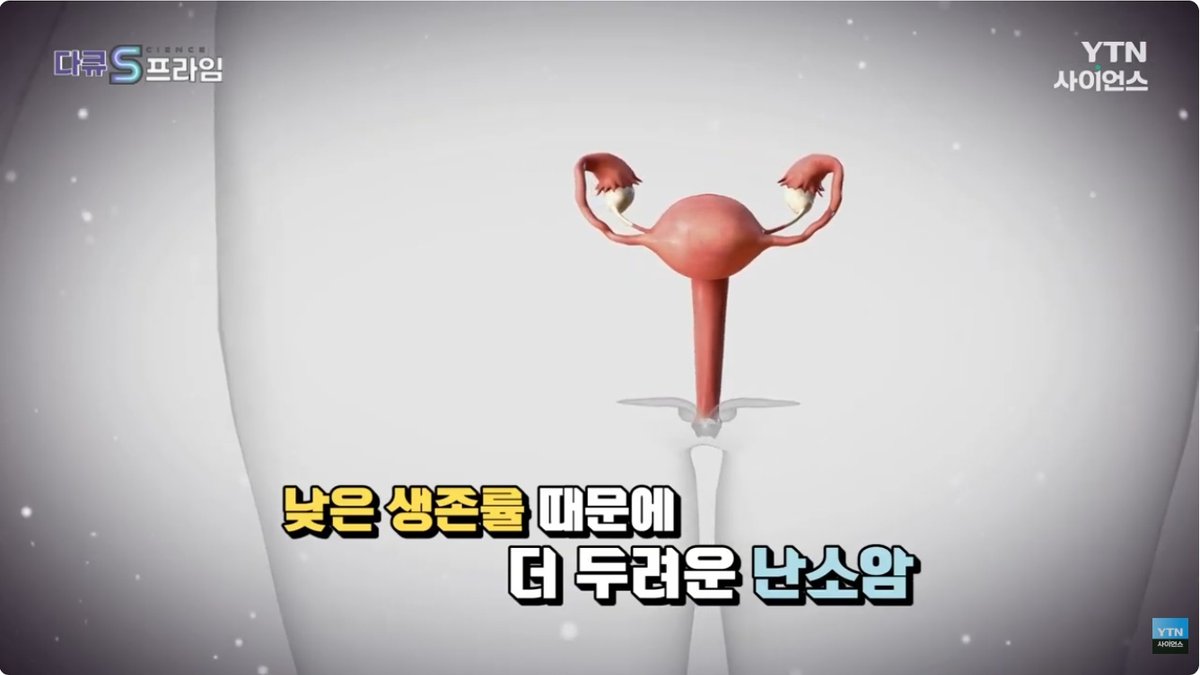 2배 늘어난 부인암 사망률 1위 ‘난소암’… 빠른 초경, 고령 출산, 저출산 속 진단도 어려워