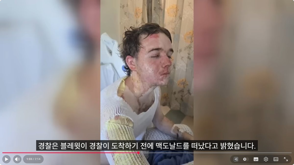 캘리포니아 맥도날드서 ‘뜨거운 기름’ 테러… 직장 폭력으로 20대 직원 중화상 입어
